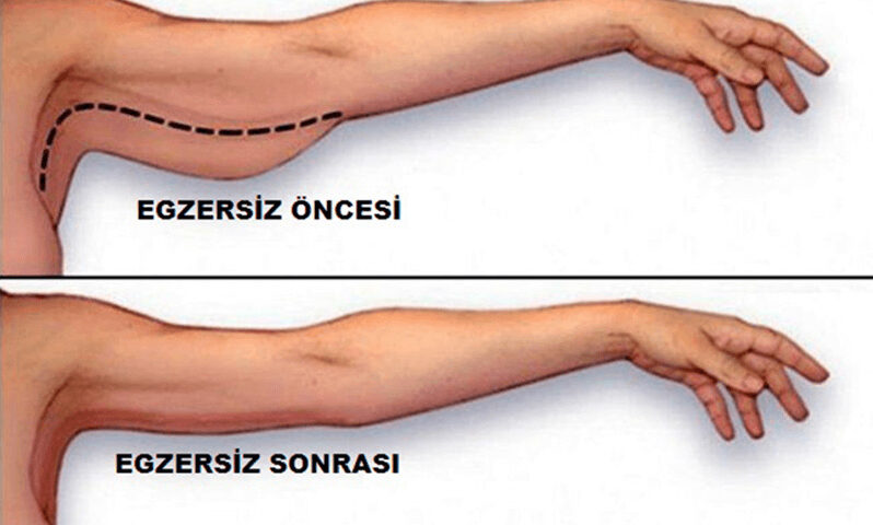 Kol Sıkılaştırıcı Egzersizler