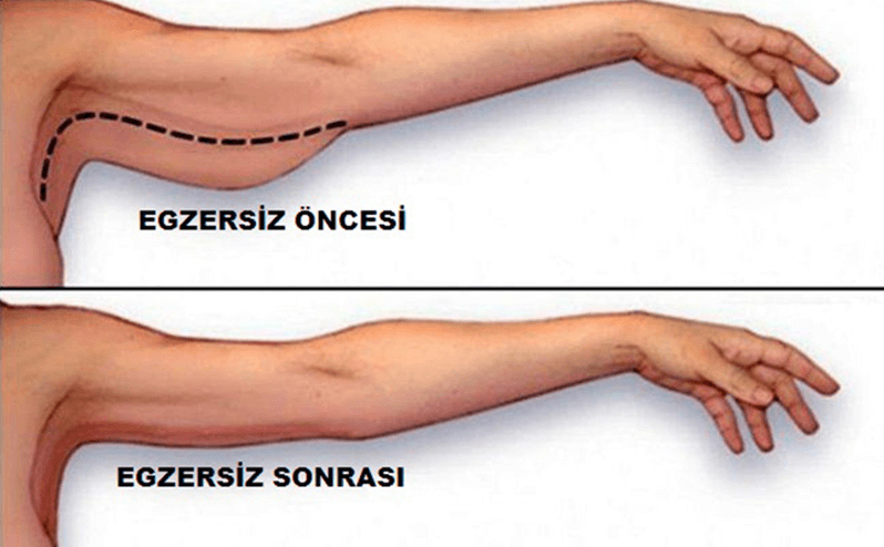 Kol Sıkılaştırıcı Egzersizler